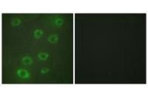 Immunofluorescence analysis of HUVEC cells, using PTX3 antibody. (PTX3 Antikörper  (N-Term))