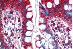 Human Small Intestine (formalin-fixed, paraffin-embedded) stained with ACSL5 antibody ABIN351483 at 2. (ACSL5 Antikörper  (AA 727-739))