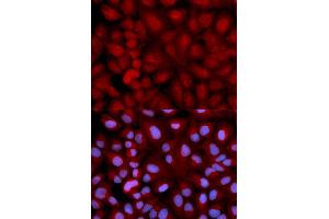 Immunofluorescence analysis of U2OS cells using SNCG antibody (ABIN5971355). (SNCG Antikörper)