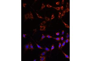 Immunofluorescence analysis of NIH-3T3 cells using PTPN13 Polyclonal Antibody (ABIN6132534, ABIN6146442, ABIN6146443 and ABIN6216830) at dilution of 1:100 (40x lens). (PTPN13 Antikörper  (AA 250-500))