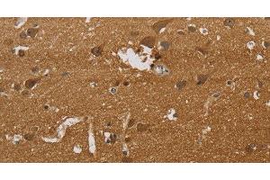 Immunohistochemistry (Paraffin-embedded Sections) (IHC (p)) image for anti-ELAV (Embryonic Lethal, Abnormal Vision, Drosophila)-Like 2 (Hu Antigen B) (ELAVL2) antibody (ABIN7243517)