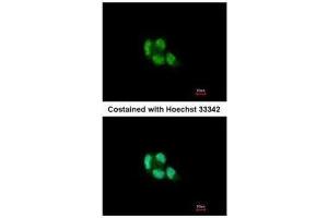 ICC/IF Image Immunofluorescence analysis of paraformaldehyde-fixed A431, using Proteasome 20S beta 5, antibody at 1:200 dilution.