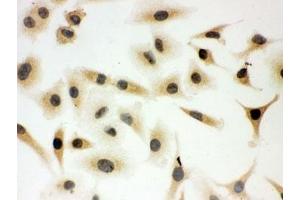 Immunocytochemistry (ICC) image for anti-SHC (Src Homology 2 Domain Containing) Transforming Protein 1 (SHC1) (C-Term) antibody (ABIN3032555)