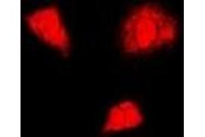 Immunofluorescent analysis of PSMA6 staining in U2OS cells. (PSMA6 Antikörper)