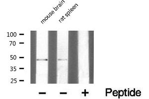 Western blot analysis of extracts of various Tissue ,using TRIM59 antibody. (TRIM59 Antikörper  (Internal Region))