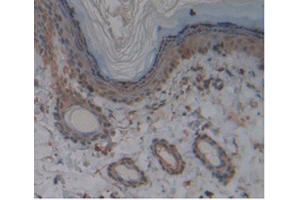 IHC-P analysis of Rat Skin Tissue, with DAB staining. (KIT Antikörper)