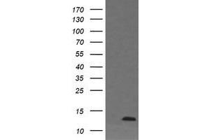 Image no. 1 for anti-D-Dopachrome Tautomerase (DDT) antibody (ABIN1497795)