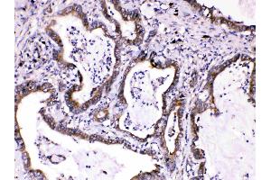 Immunohistochemistry (IHC) image for anti-Caspase 8 (CASP8) (AA 410-449), (N-Term) antibody (ABIN4886501)