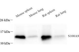 Western blot analysis of S100A9 (ABIN7075497) at dilution of 1: 800