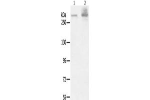 Gel: 6 % SDS-PAGE, Lysate: 40 μg, Lane 1-2: A549 cells, K562 cells, Primary antibody: ABIN7191019(HSPG2 Antibody) at dilution 1/200, Secondary antibody: Goat anti rabbit IgG at 1/8000 dilution, Exposure time: 40 seconds (HSPG2 Antikörper)