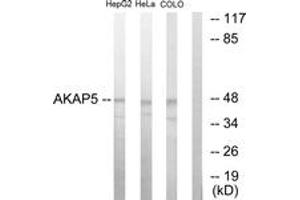 Western blot analysis of extracts from HepG2/HeLa/COLO205 cells, using AKAP5 Antibody. (AKAP5 Antikörper  (AA 1-50))