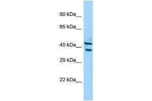 Host: Rabbit Target Name: STK35 Sample Type: A549 Whole Cell lysates Antibody Dilution: 1. (STK35 Antikörper  (C-Term))