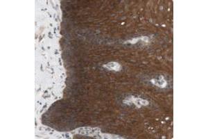 Immunohistochemical staining of human esophagus with CCDC67 polyclonal antibody  shows strong cytoplasmic positivity in squamous epithelial cells. (CCDC67 Antikörper)