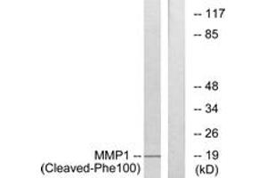 Western blot analysis of extracts from A549 cells, treated with etoposide 25uM 24h, using MMP1 (Cleaved-Phe100) Antibody.