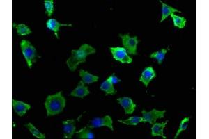 Immunofluorescence staining of SH-SY5Y cells with ABIN7140086 at 1:50, counter-stained with DAPI. (DCHS1 Antikörper  (AA 2964-2981))