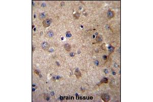 Immunohistochemistry (Paraffin-embedded Sections) (IHC (p)) image for anti-serpin Peptidase Inhibitor, Clade E (Nexin, Plasminogen Activator Inhibitor Type 1), Member 2 (SERPINE2) (AA 106-135) antibody (ABIN656538)
