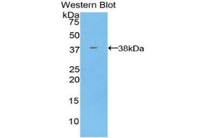 Western blot analysis of the recombinant protein. (Annexin V Antikörper  (AA 1-321))