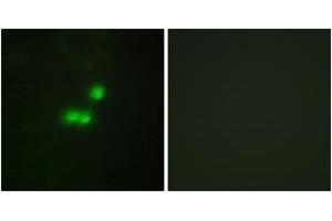 Immunofluorescence analysis of MCF7 cells, using TF3B Antibody. (BRF1 Antikörper  (AA 231-280))