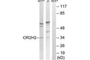 Western blot analysis of extracts from Jurkat/MCF-7 cells, using OR2H2 Antibody. (OR2H2 Antikörper  (AA 241-290))
