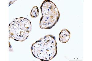 IHC analysis of RYR2 using anti-RYR2 antibody (ABIN7599921). (RYR2 Antikörper  (AA 1293-1423))
