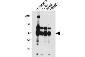 All lanes : Anti-NLRP6 Antibody (N-term) at 1:4000 dilution Lane 1: Human placenta tissue lysate Lane 2: HL-60 whole cell lysate Lane 3: Jurkat whole cell lysate Lane 4: U266B1 whole cell lysate Lysates/proteins at 20 μg per lane. (NLRP6 Antikörper  (N-Term))