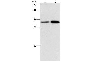 Western Blot analysis of Hela and A431 cell using CDC34 Polyclonal Antibody at dilution of 1:900 (CDC34 Antikörper)