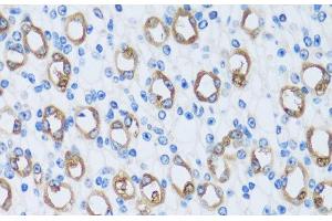 Immunohistochemistry of paraffin-embedded Mouse kidney using CA13 Polyclonal Antibody at dilution of 1:100 (40x lens).