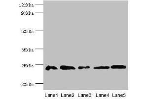 Western blot All lanes: Gstp1 antibody at 2 μg/mL Lane 1: Mouse kidney tissue Lane 2: Jurkat whole cell lysate Lane 3: K562 whole cell lysate Lane 4: 293T whole cell lysate Lane 5: Hela whole cell lysate Secondary Goat polyclonal to rabbit IgG at 1/10000 dilution Predicted band size: 24 kDa Observed band size: 24 kDa (GSTP1 Antikörper  (AA 2-210))