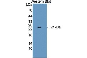 Western blot analysis of the recombinant protein. (FTL Antikörper  (AA 2-175))