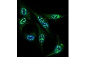 Immunofluorescence analysis of HepG2 cells using INCENP antibody (green). (INCENP Antikörper  (AA 369-583))