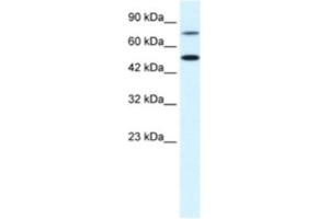 Western Blotting (WB) image for anti-Choroideremia-Like (Rab Escort Protein 2) (CHML) antibody (ABIN2463728) (CHML Antikörper)