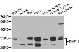 Western blot analysis of extracts of various cell lines, using PHF11 Antibody (ABIN5975729) at 1/1000 dilution.