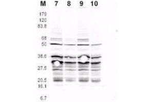 This product was assayed by western blotting against RFA2 containing cell lysates. (RPA2 Antikörper  (pSer122))