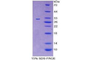 SDS-PAGE (SDS) image for CD109 (CD109) (AA 719-965) protein (His tag) (ABIN2124358)