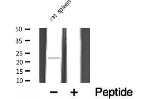 Western blot analysis of extracts from rat spleen, using TUSC5 antibody. (TUSC5 Antikörper  (N-Term))