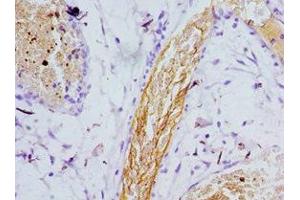 Immunohistochemistry of paraffin-embedded human epityphlon tissue using ABIN7164263 at dilution of 1:100 (Presenilin 1 Antikörper  (AA 1-160))