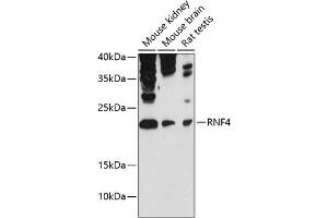 Western blot analysis of extracts of various cell lines, using RNF4 antibody (ABIN6129121, ABIN6147041, ABIN6147042 and ABIN6215602) at 1:3000 dilution. (RNF4 Antikörper  (AA 1-190))