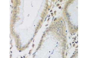 Immunohistochemistry of paraffin-embedded Human stomach using ENPEP Polyclonal Antibody at dilution of 1:200 (40x lens). (ENPEP Antikörper)