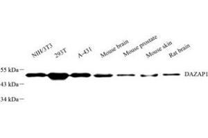 Western blot analysis of DAZAP1 (ABIN7073691) at dilution of 1: 2000 (DAZAP1 Antikörper)