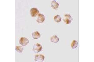 Immunocytochemistry staining of K562 cells usingAcinus Antibody Cat. (ACIN1 Antikörper)