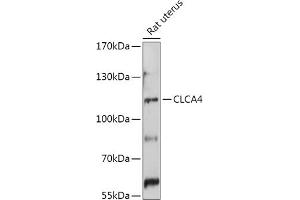 Western blot analysis of extracts of Rat uterus, using CLC antibody (ABIN7266332) at 1:1000 dilution. (CLCA4 Antikörper  (AA 22-150))