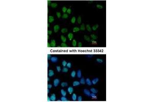 ICC/IF Image Immunofluorescence analysis of paraformaldehyde-fixed Human ESC, using ZNF281, antibody at 1:100 dilution. (ZNF281 Antikörper)