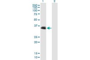Western Blot analysis of CENPV expression in transfected 293T cell line by CENPV MaxPab polyclonal antibody. (CENPV Antikörper  (AA 1-275))