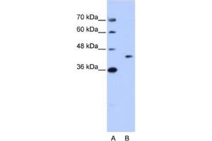 Western Blotting (WB) image for anti-GIPC PDZ Domain Containing Family, Member 1 (GIPC1) antibody (ABIN2462192) (GIPC1 Antikörper)