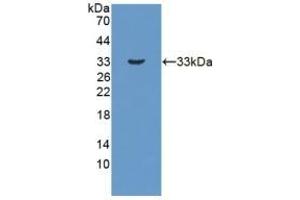Detection of Recombinant HSD17b3, Human using Polyclonal Antibody to 17-Beta-Hydroxysteroid Dehydrogenase Type 3 (HSD17b3) (HSD17B3 Antikörper  (AA 1-310))