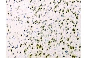 IHC analysis of hnRNP A2B1 using anti-hnRNP A2B1 antibody (ABIN5692872).