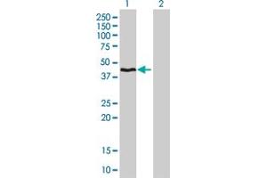 Western Blot analysis of HMBS expression in transfected 293T cell line by HMBS monoclonal antibody (M01), clone 3E8.