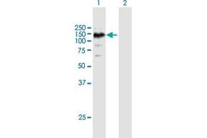 Western Blot analysis of EPHA6 expression in transfected 293T cell line by EPHA6 MaxPab polyclonal antibody. (EPH Receptor A6 Antikörper  (AA 1-1036))