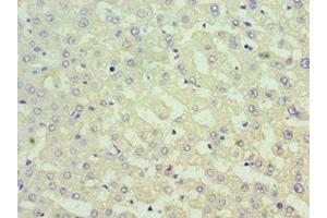 Immunohistochemistry of paraffin-embedded human liver tissue using ABIN7171013 at dilution of 1:100