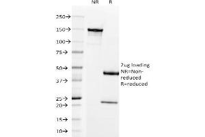 SDS-PAGE Analysis Purified Prolactin Receptor Mouse Monoclonal Antibody (B6. (Prolactin Receptor Antikörper)